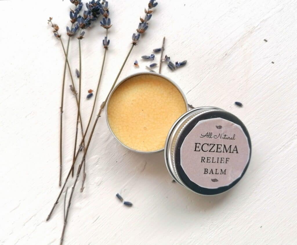 Homemade Eczema Ointment